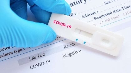 Cколько могут сохраняться антитела к коронавирусу, рассказали ученые
